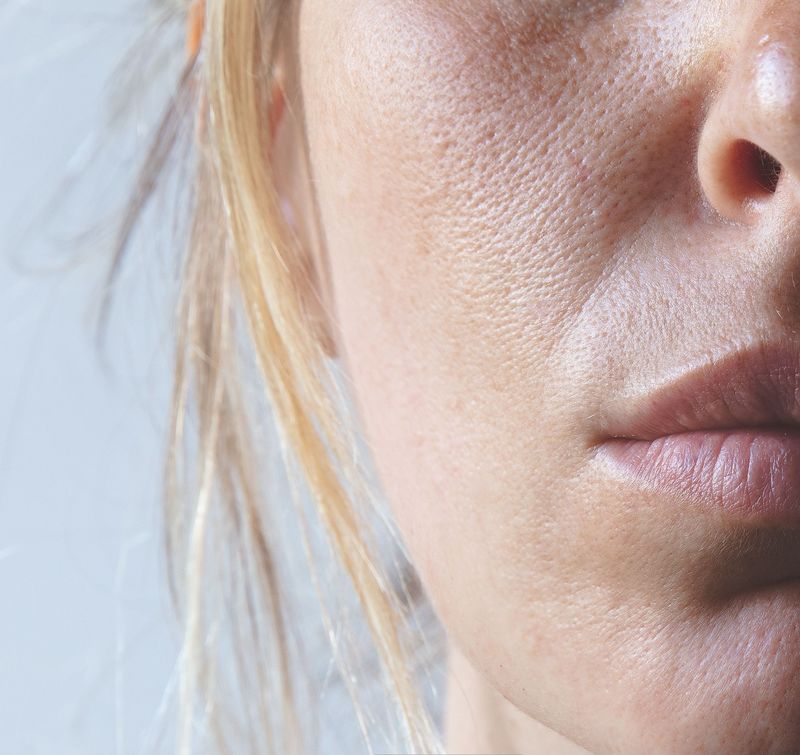 Skin Starter Pack HöbePergh: where to start with your skincare