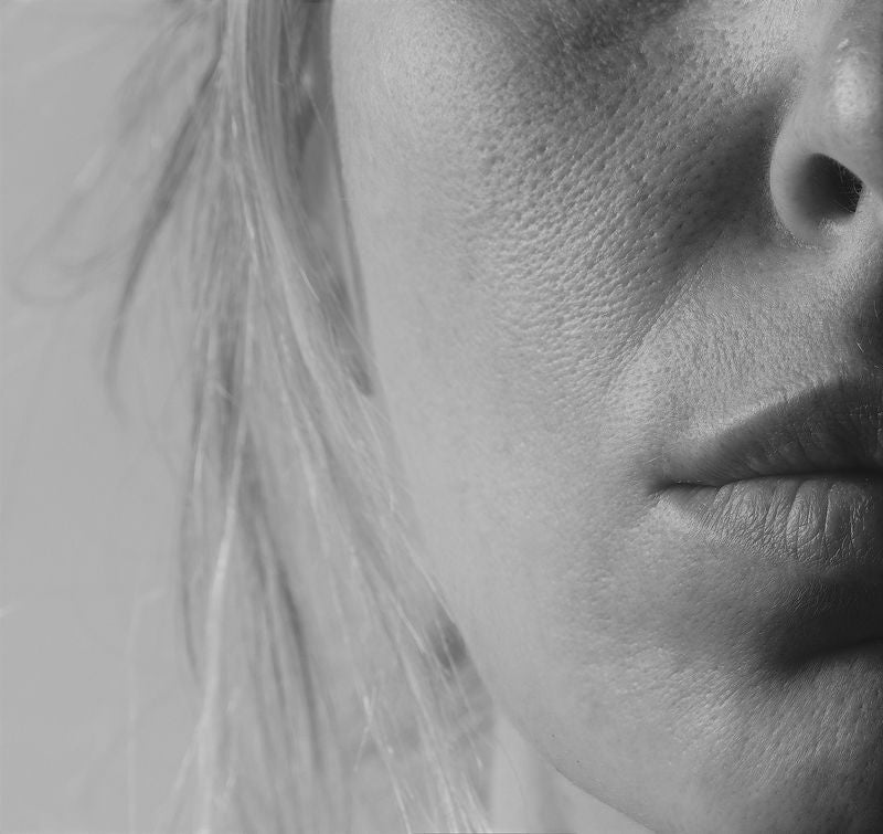 Skin Starter Pack HöbePergh: where to start with your skincare